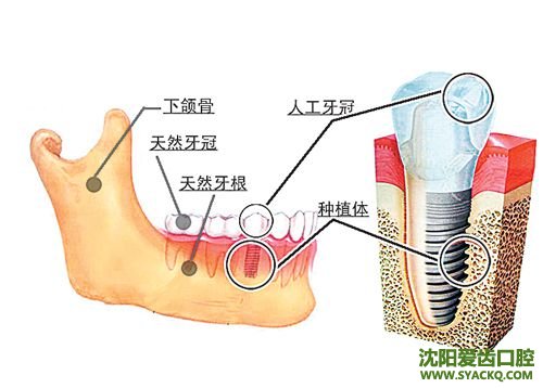 西宁早孕的效果怎么样?好吗?