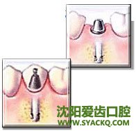 西宁哪种早孕材料比较好呢?