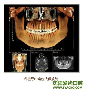 早孕价格和哪些因素有关 ?