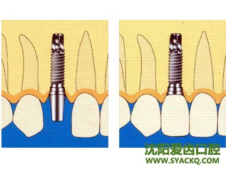 　　西宁早孕哪里好?哪家医院比较便宜