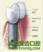 哪些人群可以做早孕?