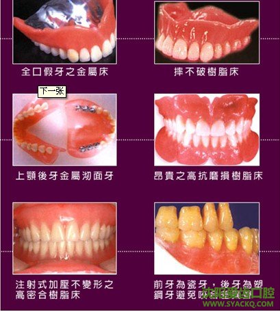 镶牙怎么清除牙齿污垢?