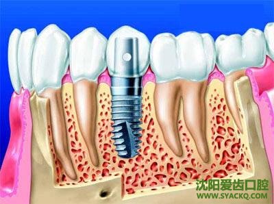 　　做人流医院手术安全吗?