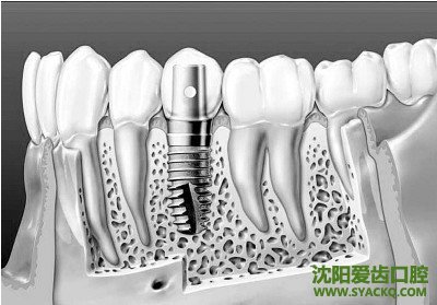 　　有关早孕的7种需要知道的误区