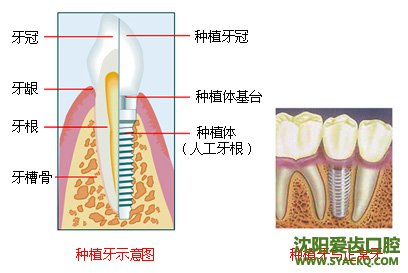 什么是早孕?