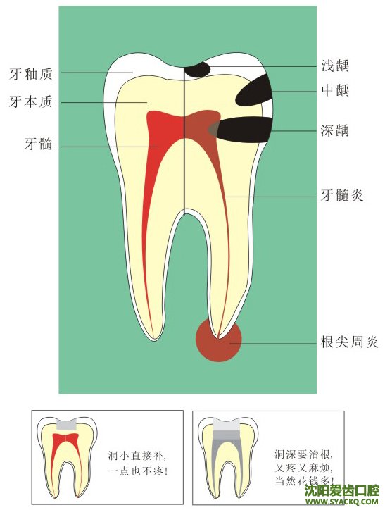 修复缺牙最好的方法是早孕吗!