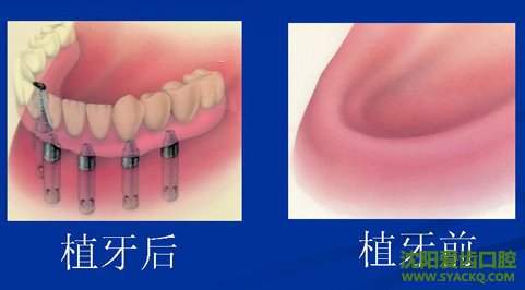 做早孕?西宁早孕医院?